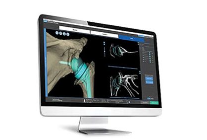 CT DICOM viewer screenshot